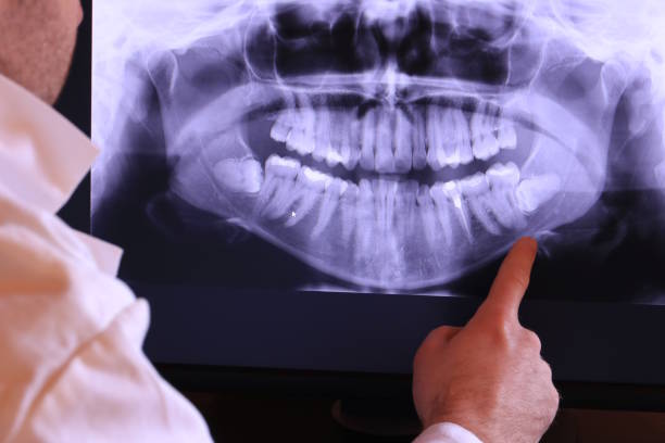 Best Broken or Chipped Tooth Repair in Rancho Mission Viejo, CA