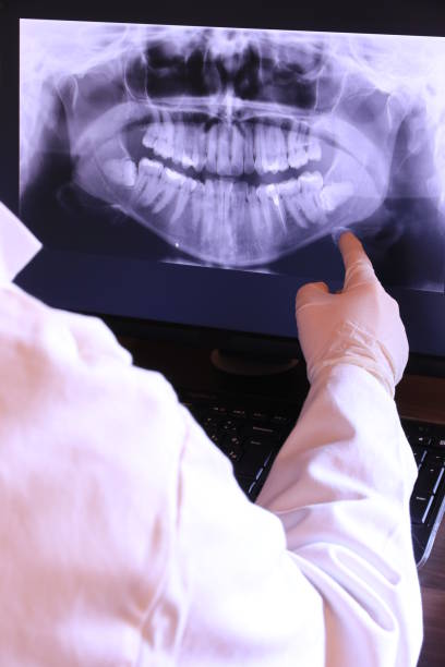 Best Dental Abscess Treatment in Rancho Mission Viejo, CA