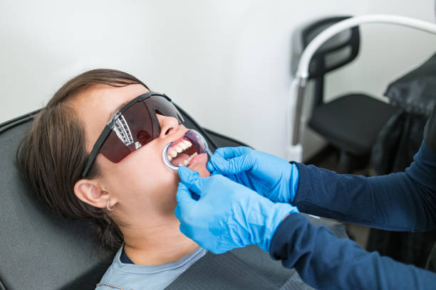 Best Knocked-Out Tooth (Avulsed Tooth) Treatment in Rancho Mission Viejo, CA