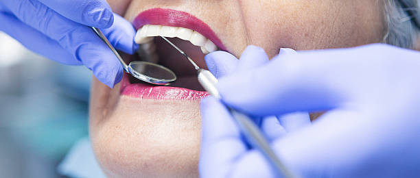 Best Emergency Denture Repair in Rancho Mission Viejo, CA